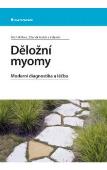 Děložní myomy: Michal Mára, Holub Zdeněk